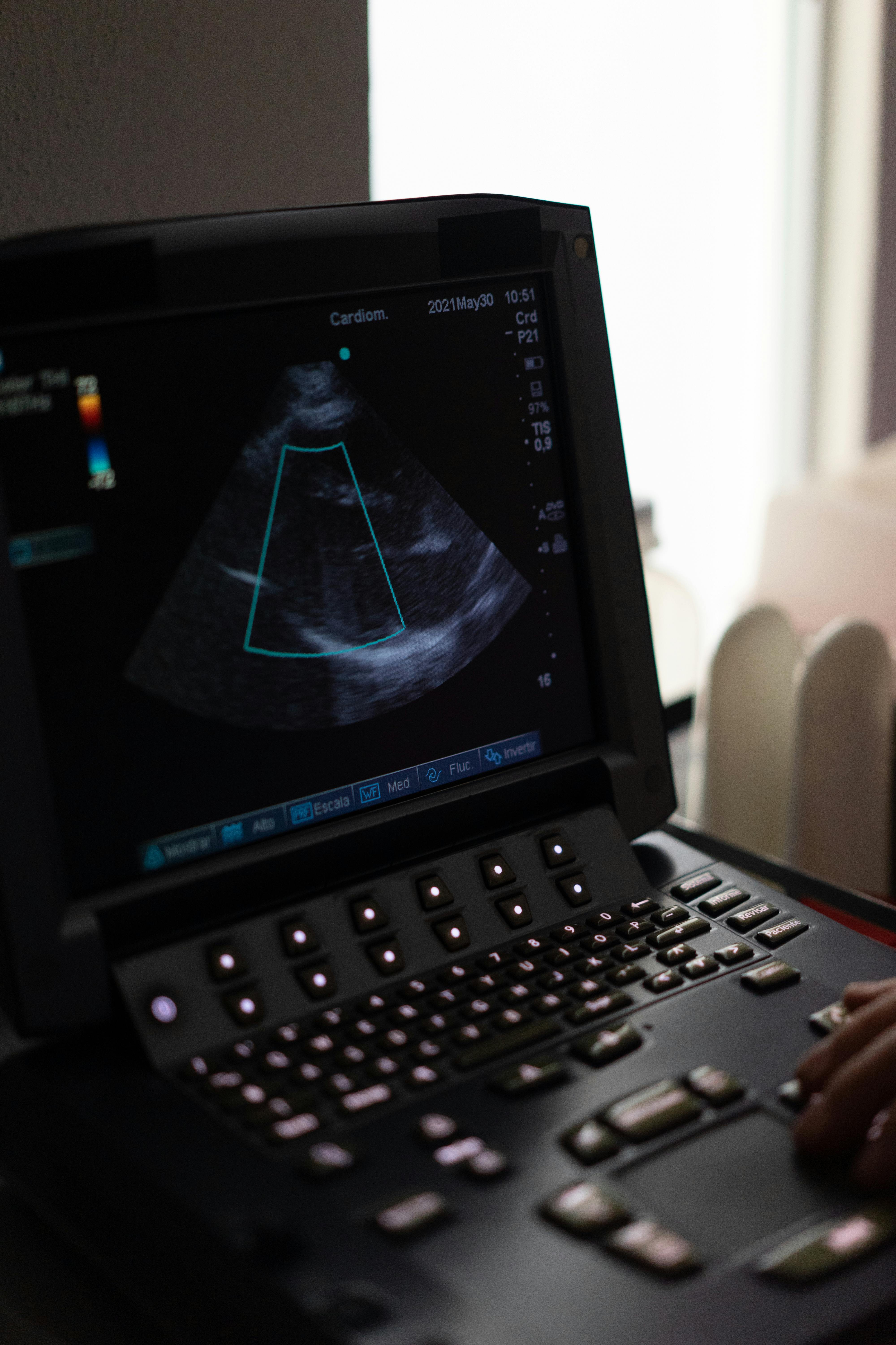 An Engineer's Breakdown: Philips PureWave vs. Conventional Ultrasound Probes
